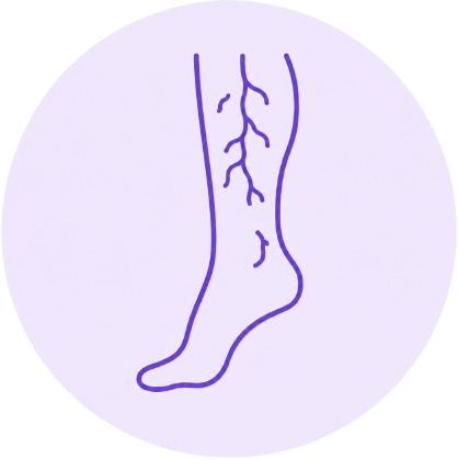 Ícono úlceras venosas