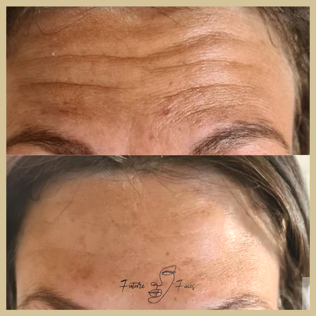 Future Faces 25 Winter Offer