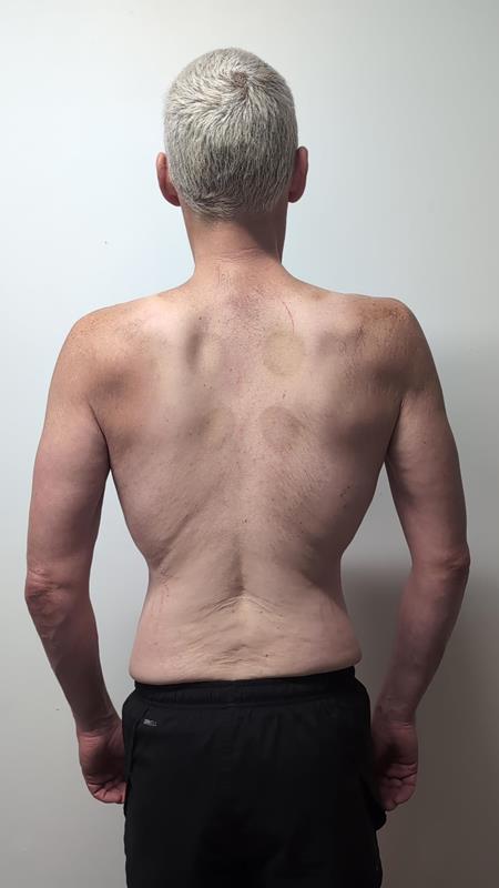 Doyle after - back