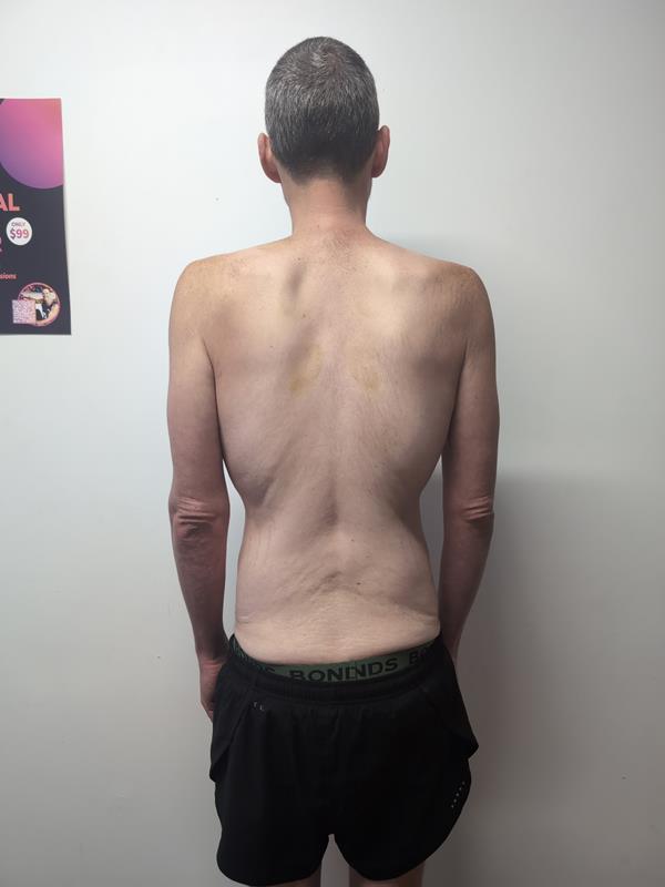 Doyle before - back