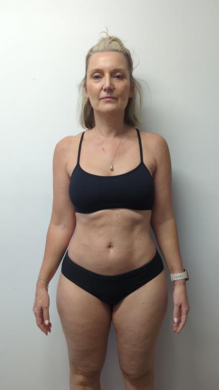 Nikki before - front