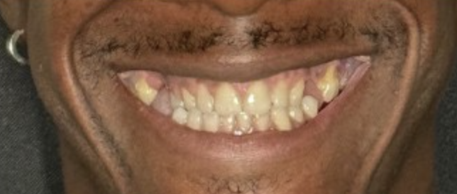 Before