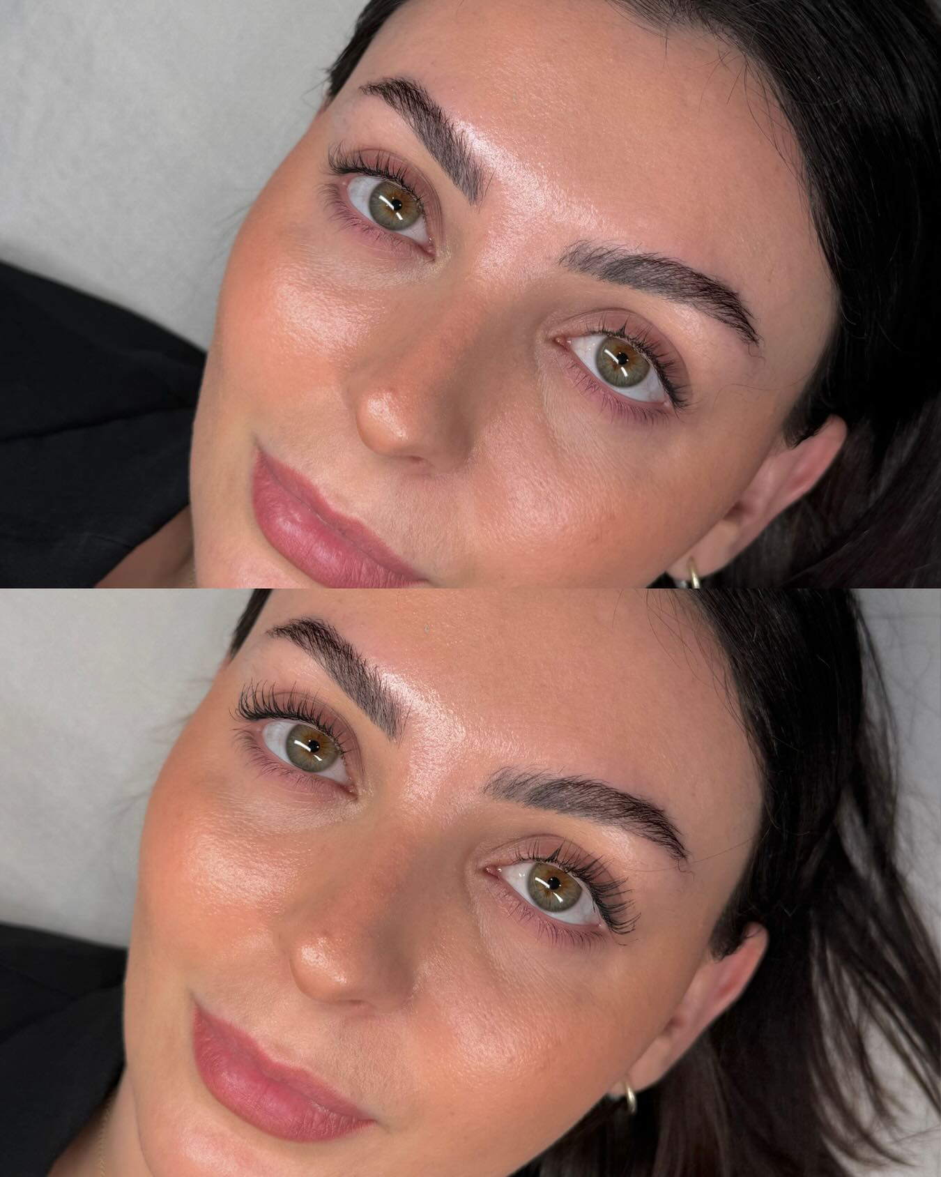 Client skin result 13 before and after treatment at Curated Skin Aesthetics