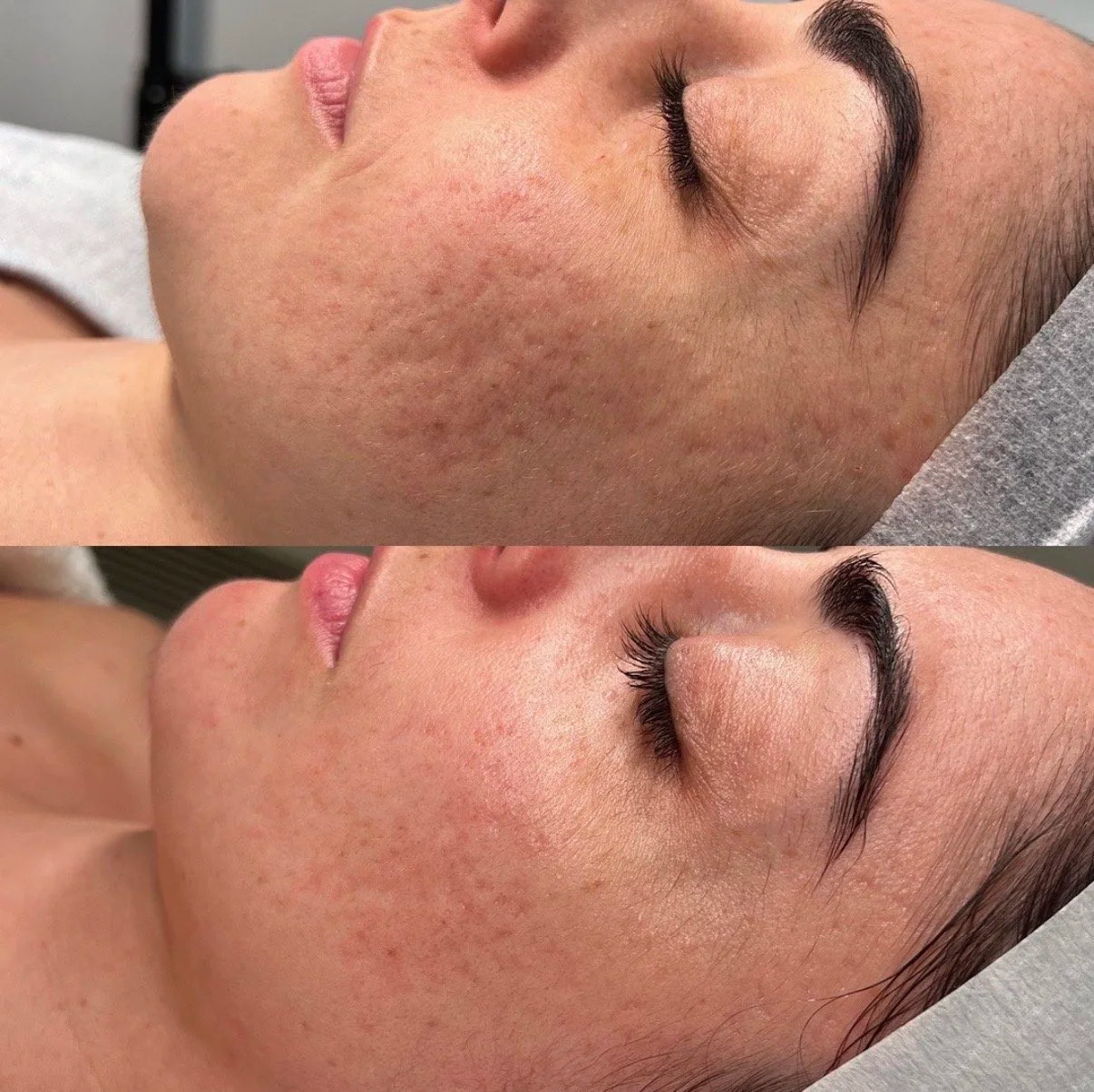 Client skin result 3 before and after treatment at Curated Skin Aesthetics