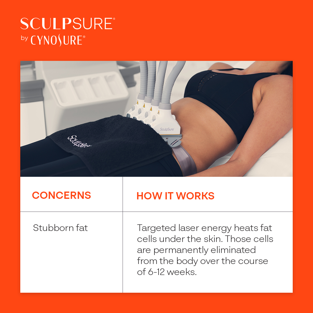 SculpSure laser fat removal treatment on abdomen in Clifton NJ SculpSure laser fat removal treatment on abdomen in Clifton NJ