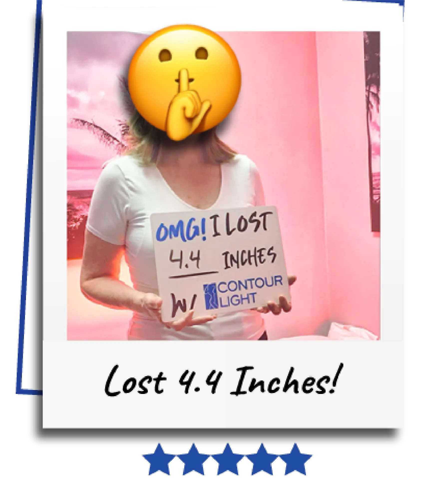 Non-invasive weight loss before and after results Clifton NJ