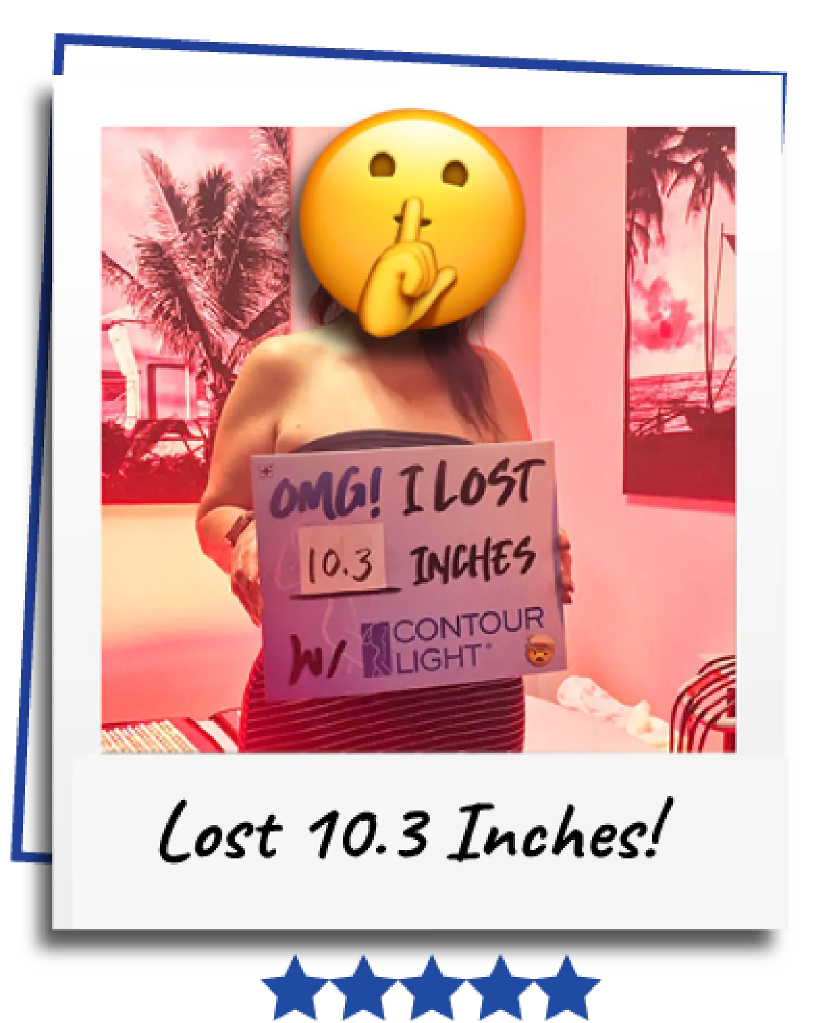 SculpSure before and after results at Transformative 360 Clifton NJ SculpSure before and after results at Transformative 360 Clifton NJ