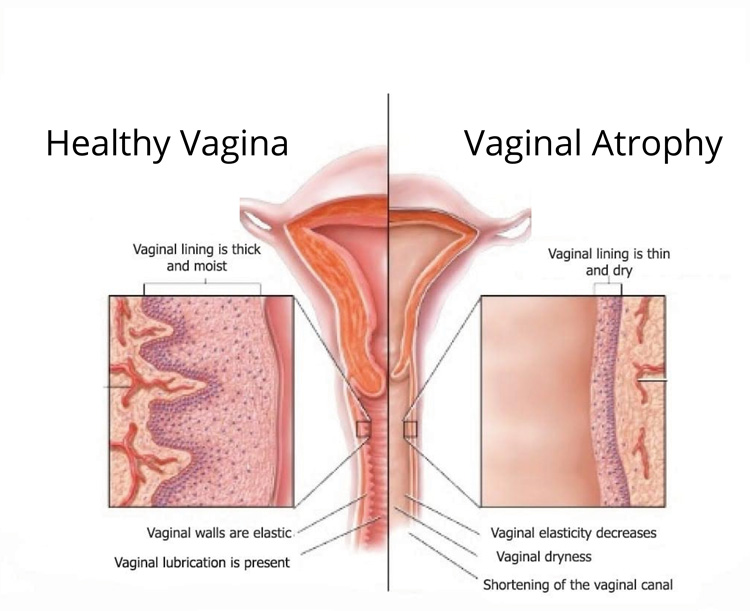 Women's sexual health treatment at Desert Sands Aesthetics & Laser, St. George Utah