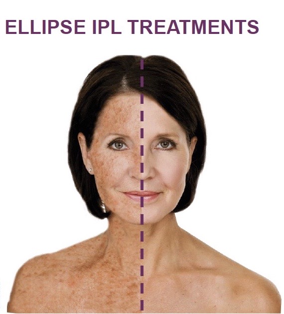 Professional skincare treatment at Desert Sands Aesthetics & Laser, St. George Utah