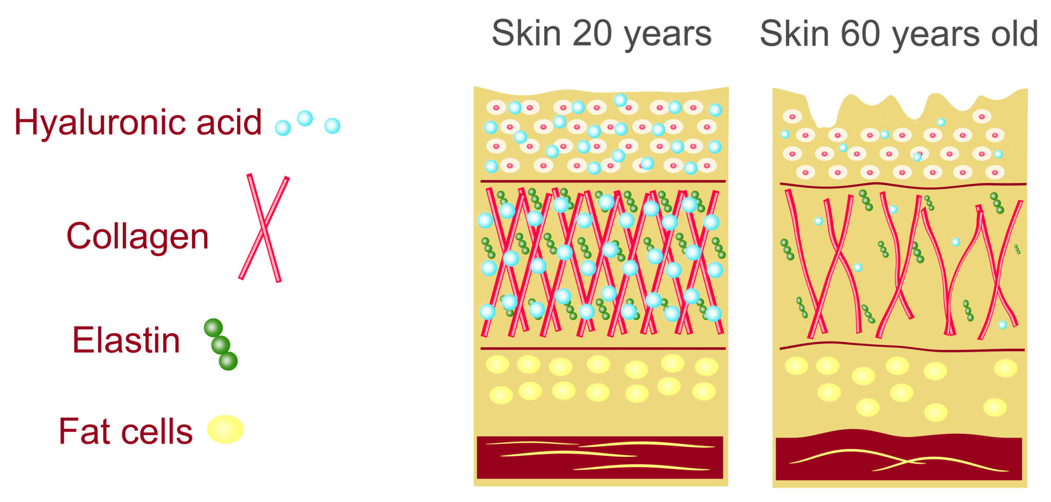 Skin aging diagram showing collagen, elastin, and hyaluronic acid decline — Profound Lift, Desert Sands St. George Utah