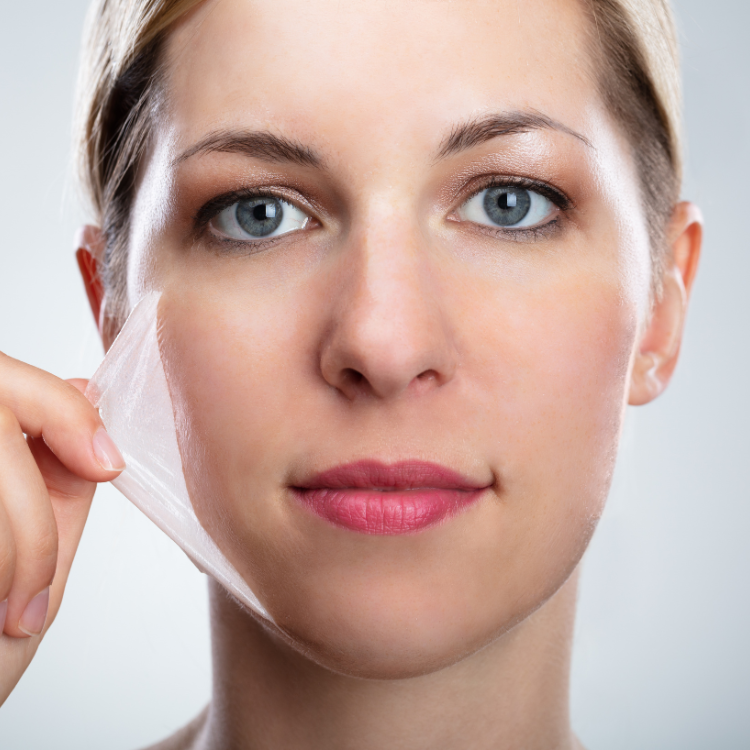 Chemical peel treatment at Desert Sands Aesthetics & Laser, St. George Utah