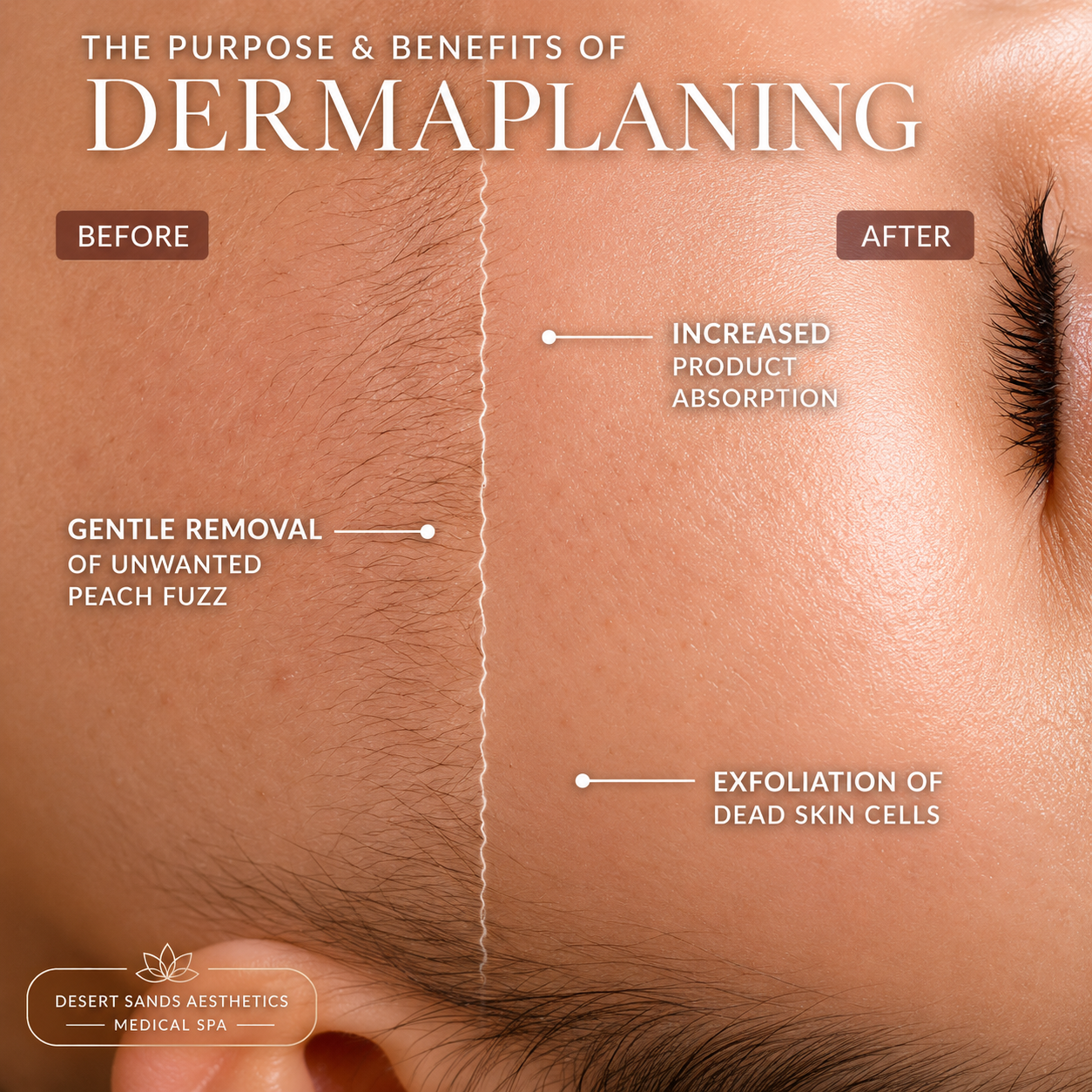 Dermaplaning treatment at Desert Sands Aesthetics & Laser, St. George Utah