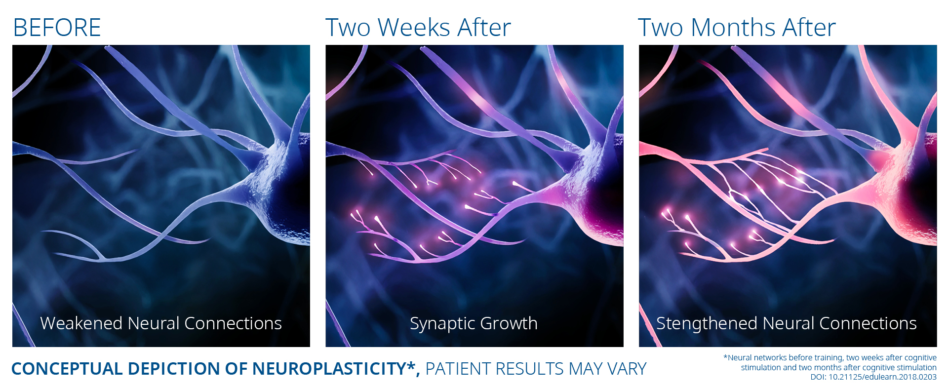Comparison showing EXOMIND brain changes at 2 weeks and 2 months of therapy