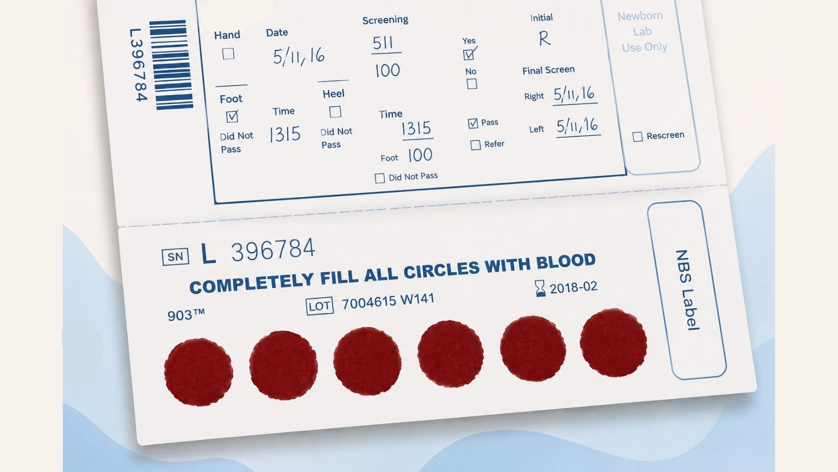 newborn screen blood spot example