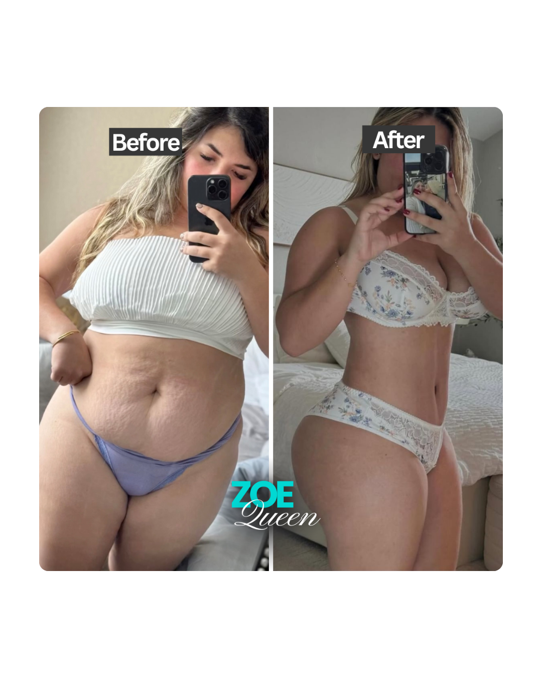 Zoe patient before and after weight loss