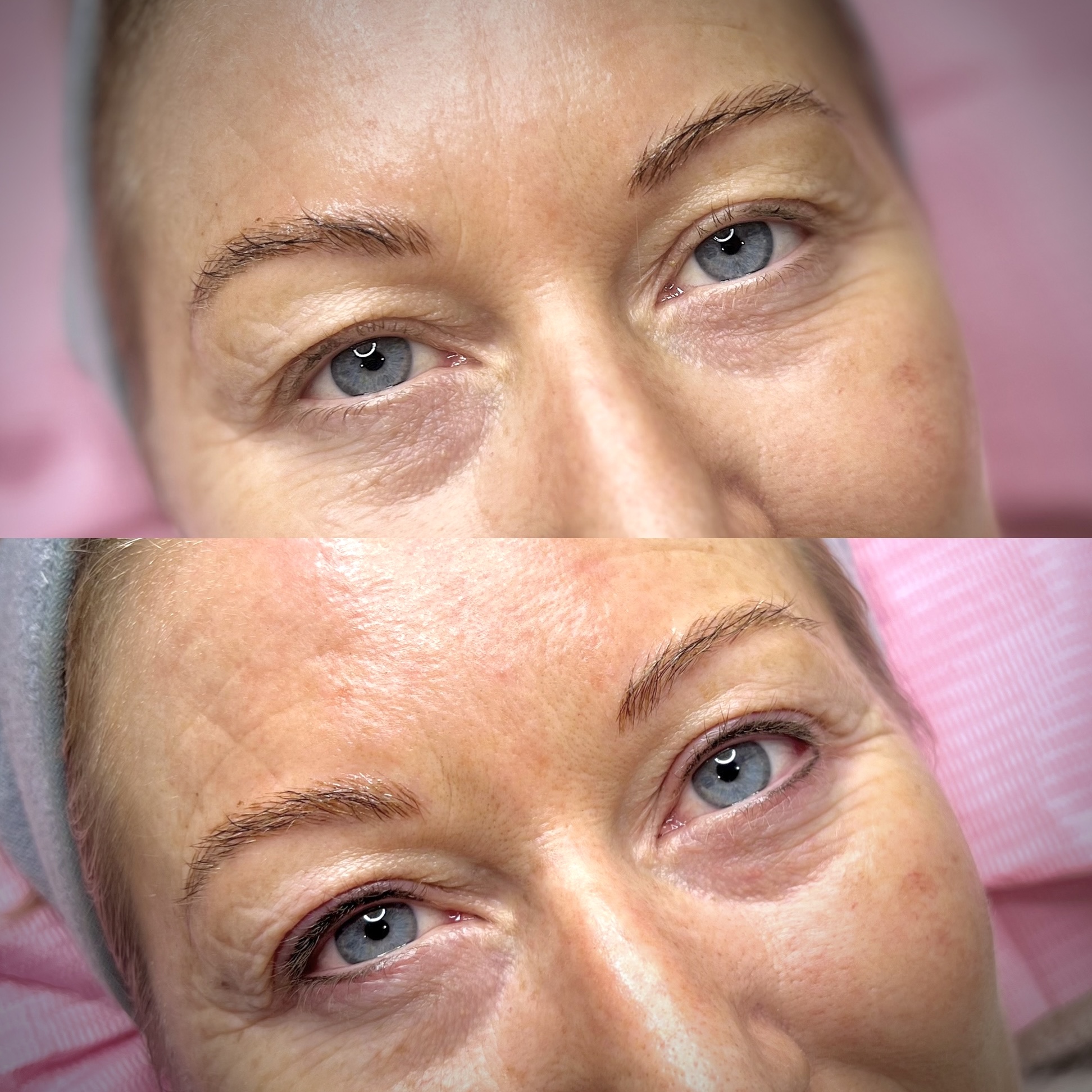 Upper and lower eyeliner composite photograph, shown intact