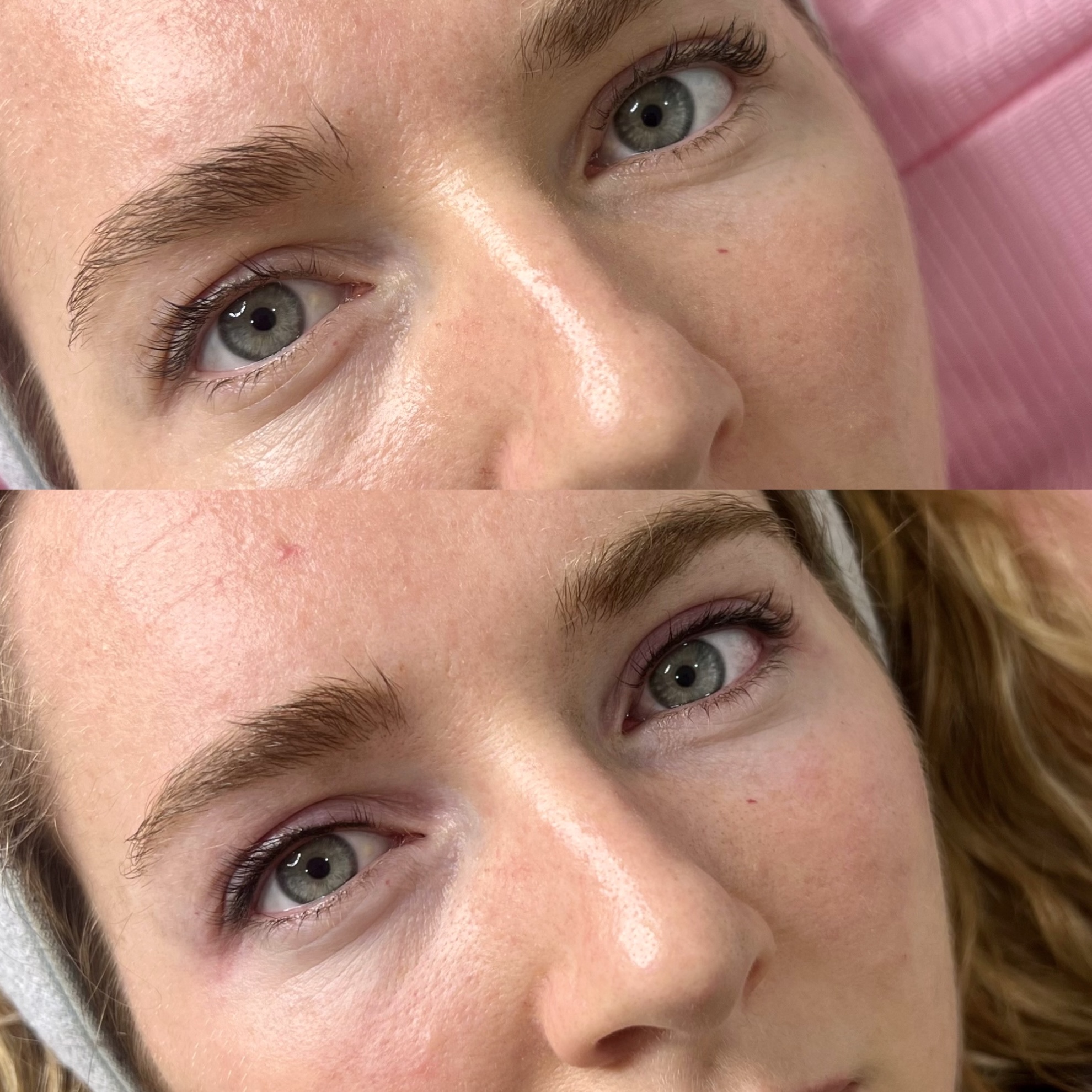 Upper eyeliner composite photograph, shown intact