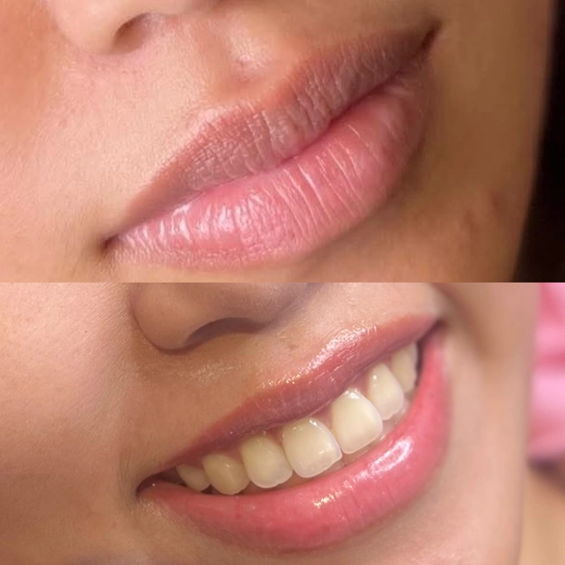 Lip Blush photograph shown intact at its original proportions