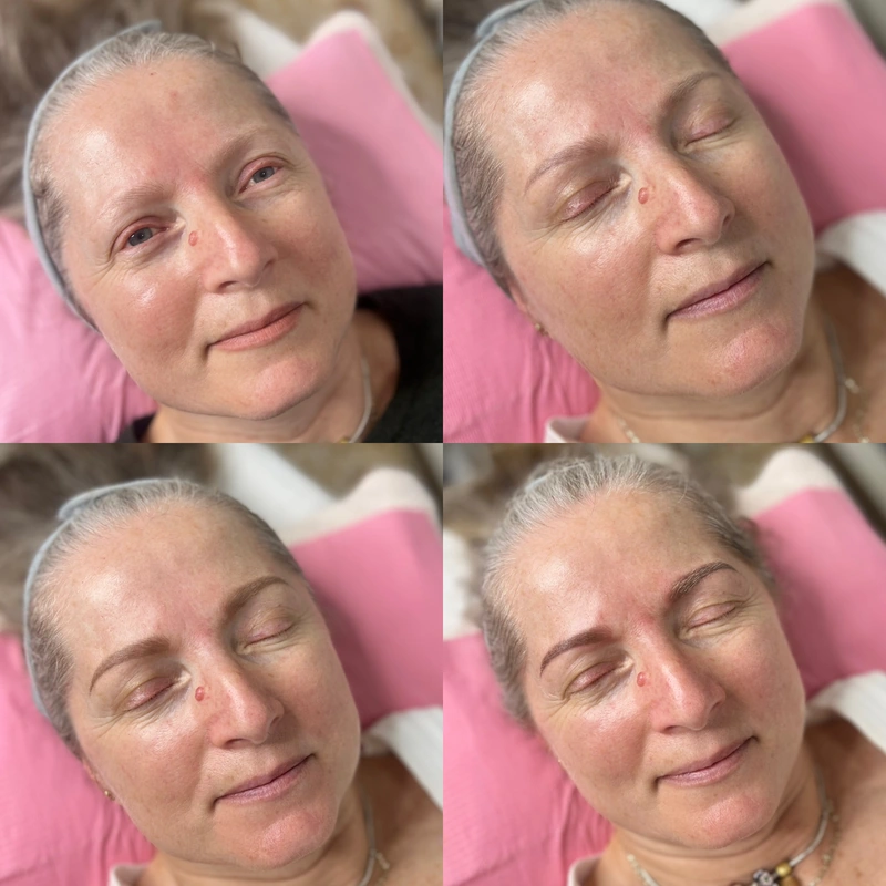 Brows photograph shown intact at its original proportions