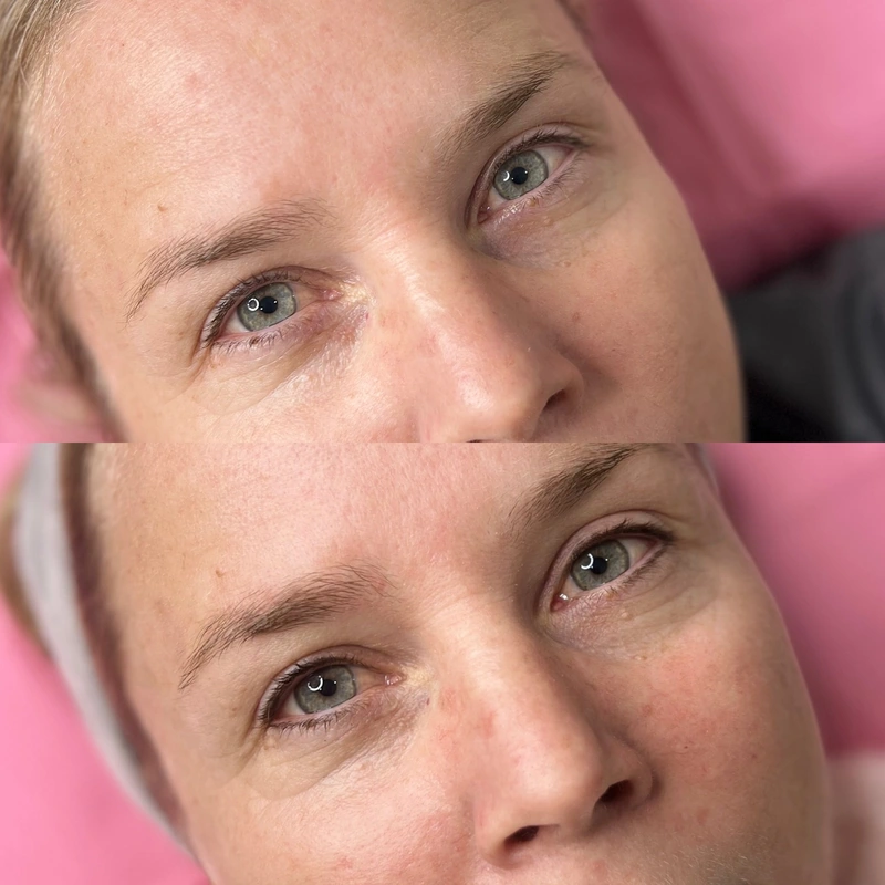 Inner Eyeliner photograph shown intact at its original proportions