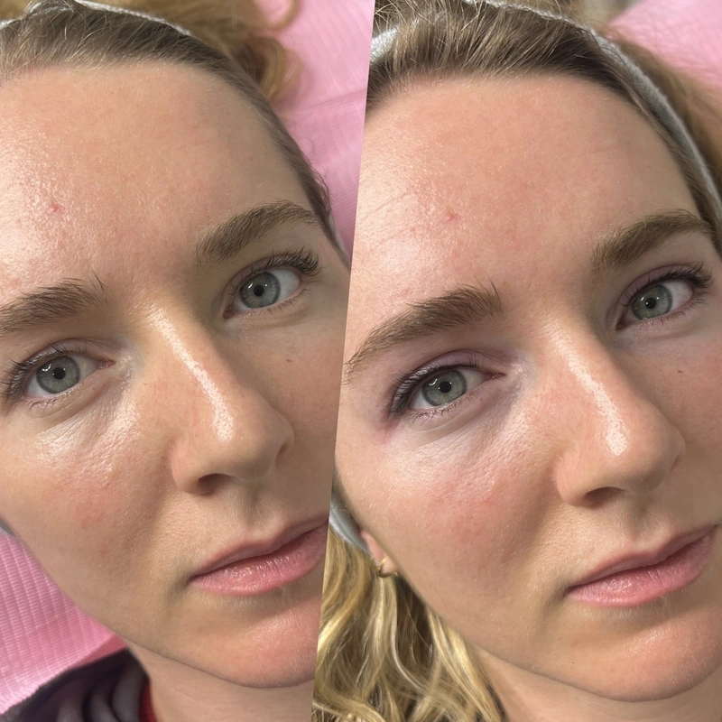 Inner Eyeliner photograph shown intact at its original proportions