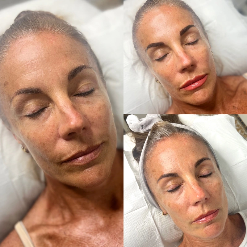 Cosmetic tattooing photograph shown intact at its original proportions