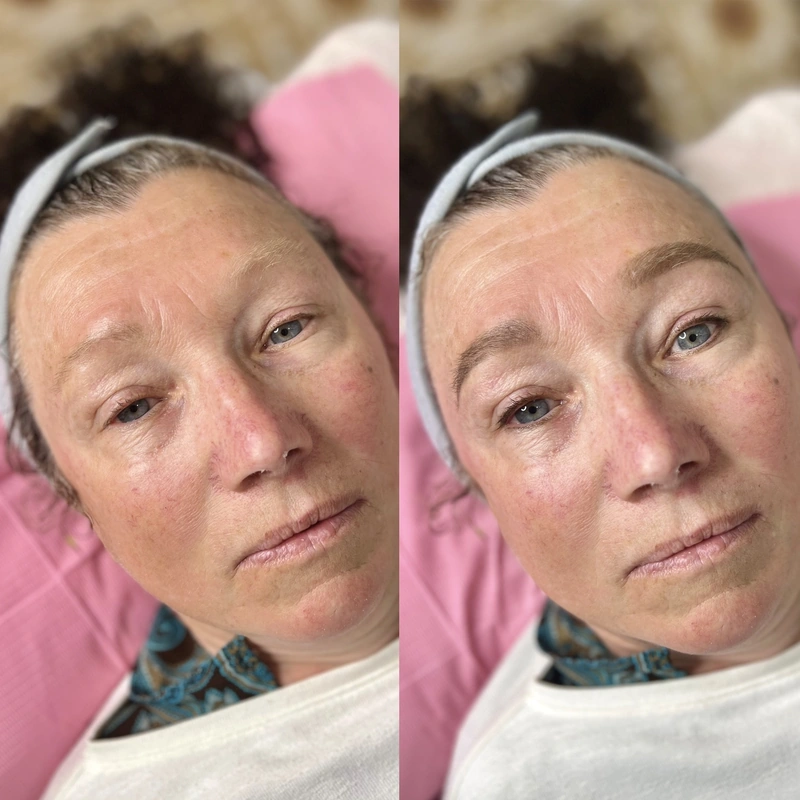 Cosmetic tattooing photograph shown intact at its original proportions