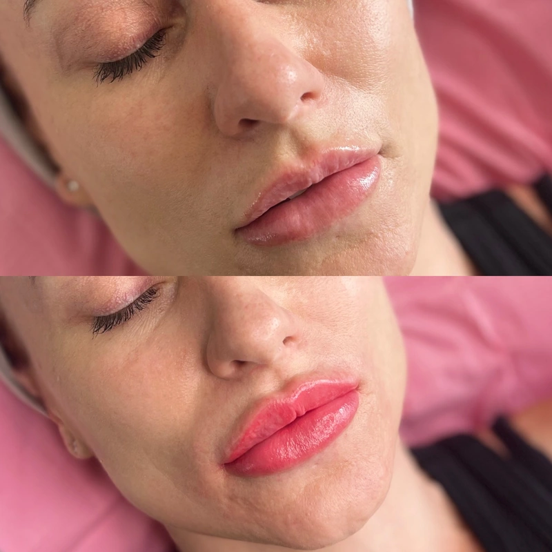 Cosmetic tattooing photograph shown intact at its original proportions