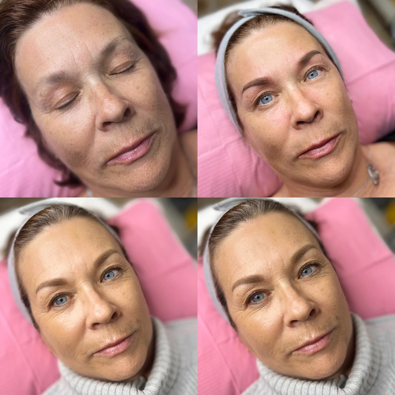 Brows photograph shown intact at its original proportions