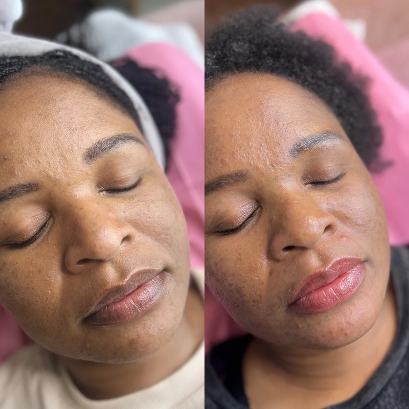 Cosmetic tattooing photograph shown intact at its original proportions