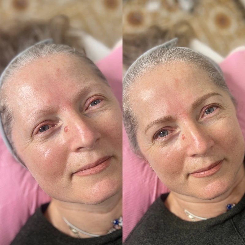 Brows photograph shown intact at its original proportions