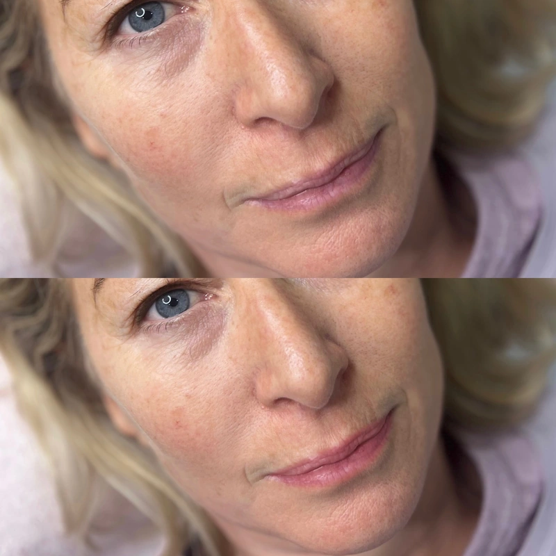 Cosmetic tattooing photograph shown intact at its original proportions