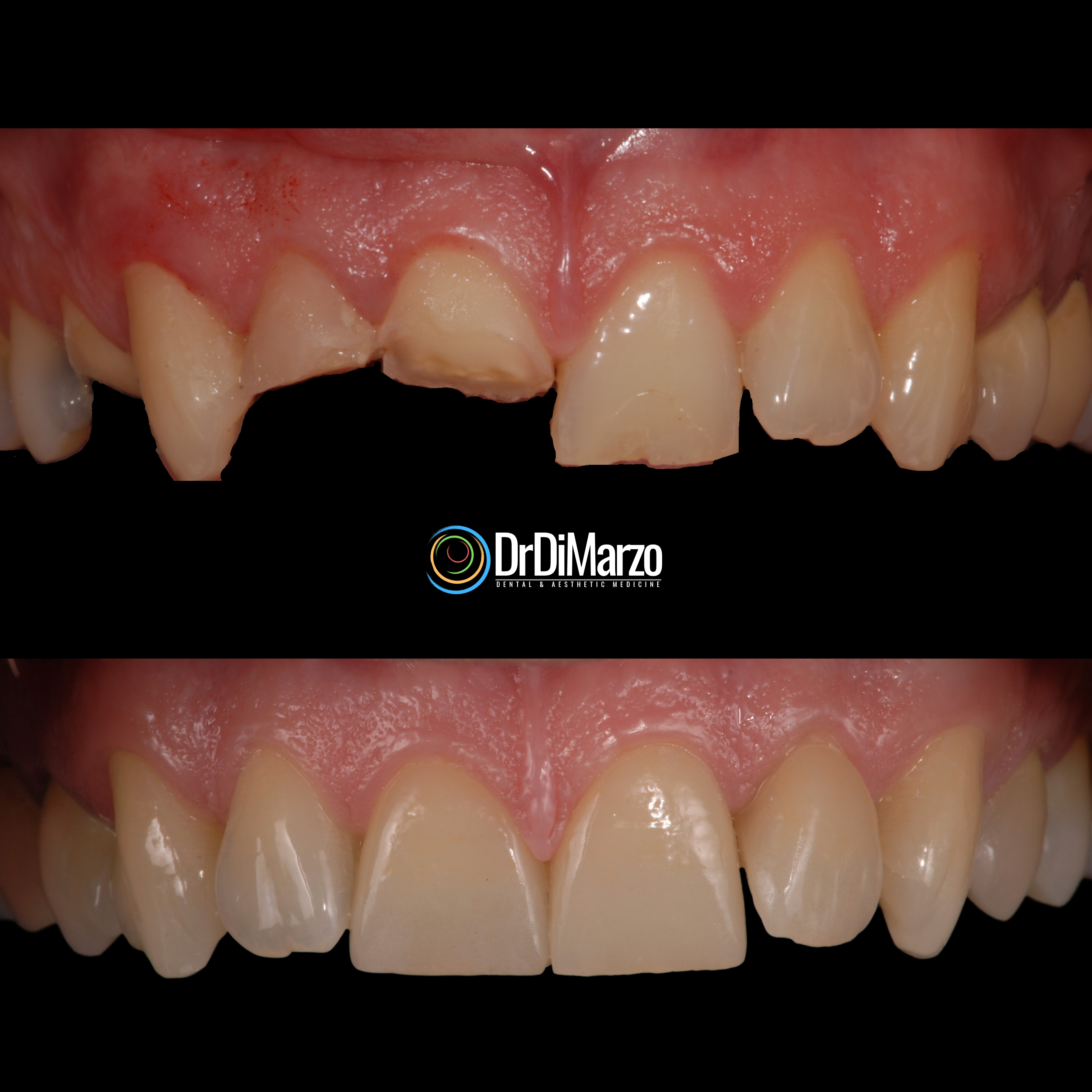 Trasformazione Prima e Dopo