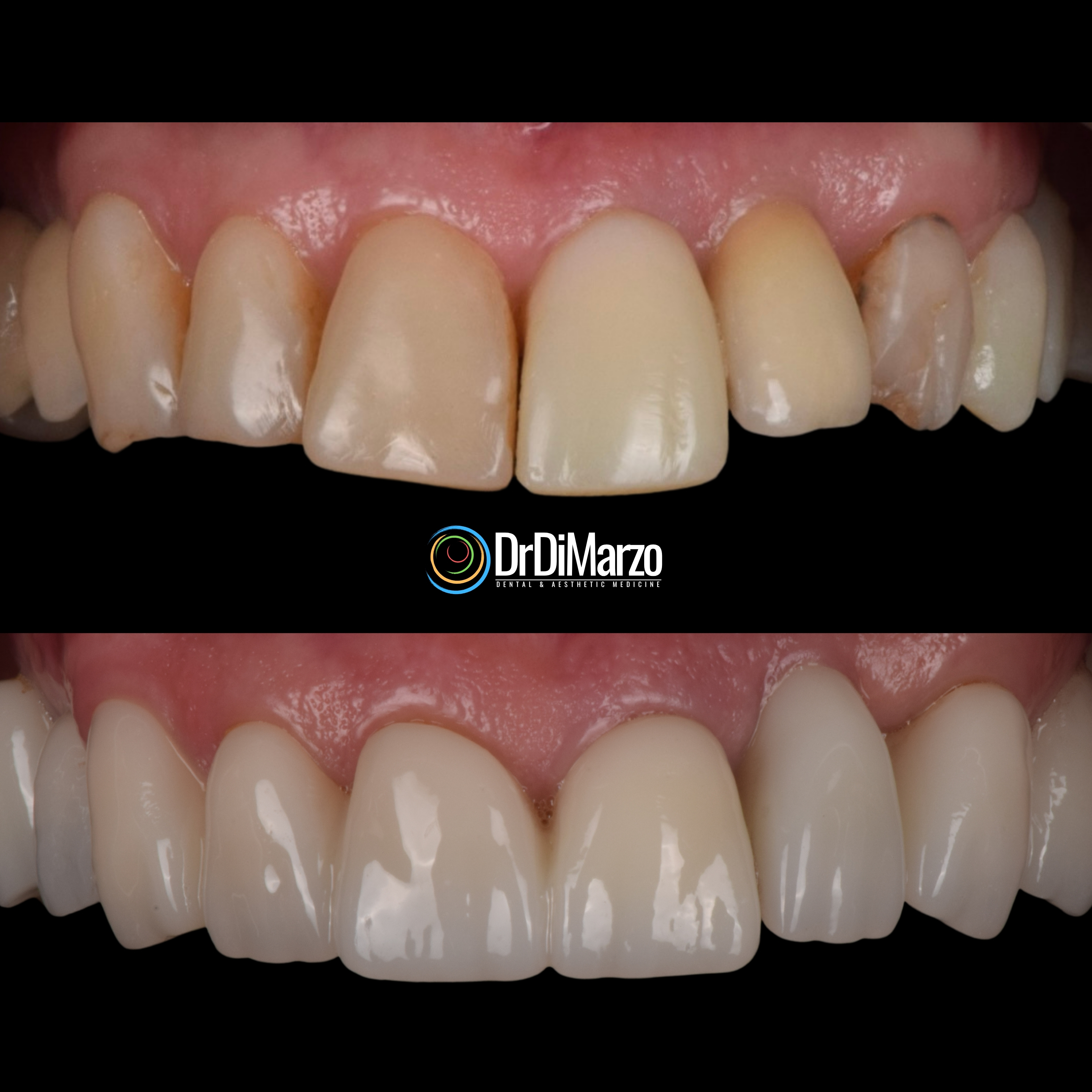 Trasformazione Prima e Dopo