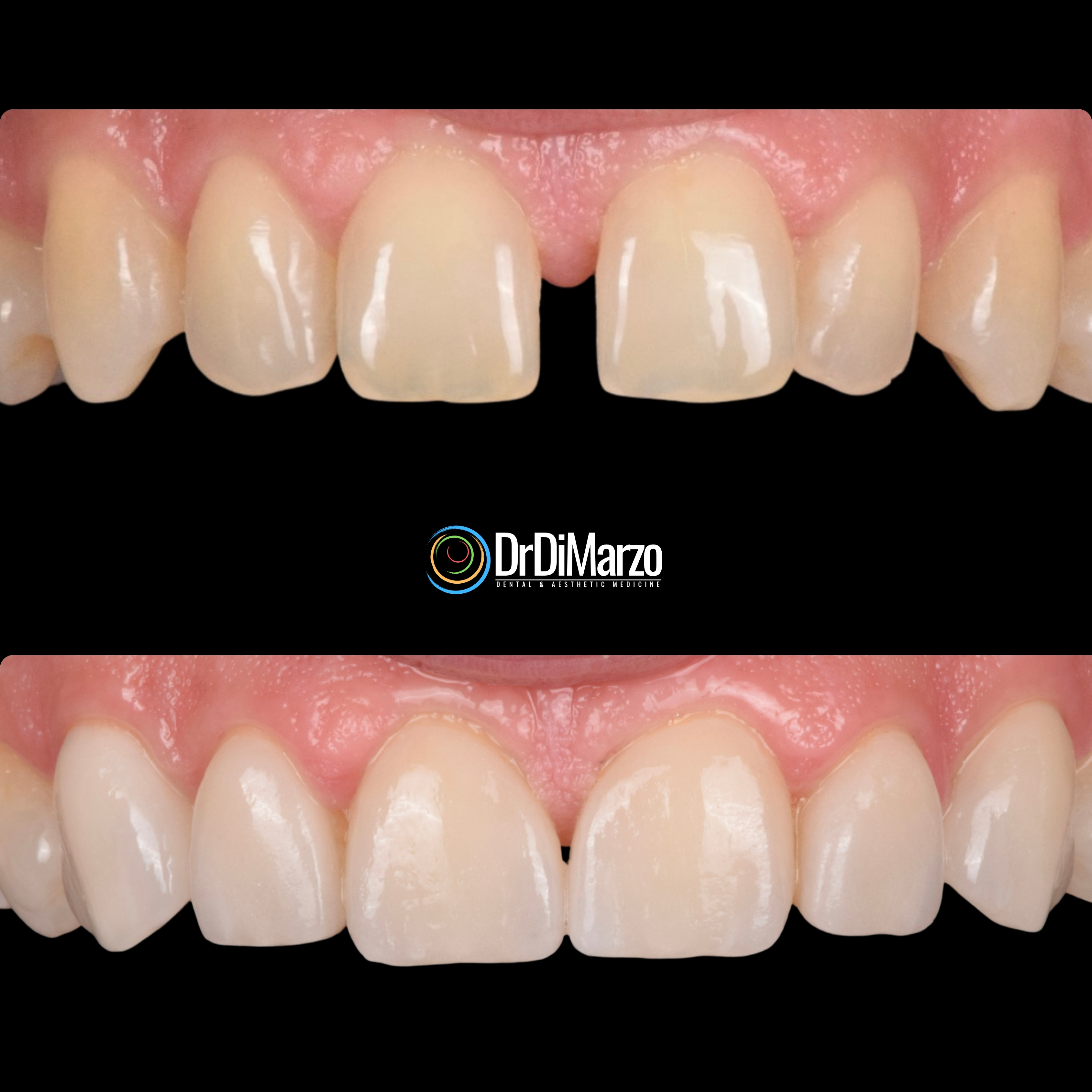 Trasformazione Prima e Dopo