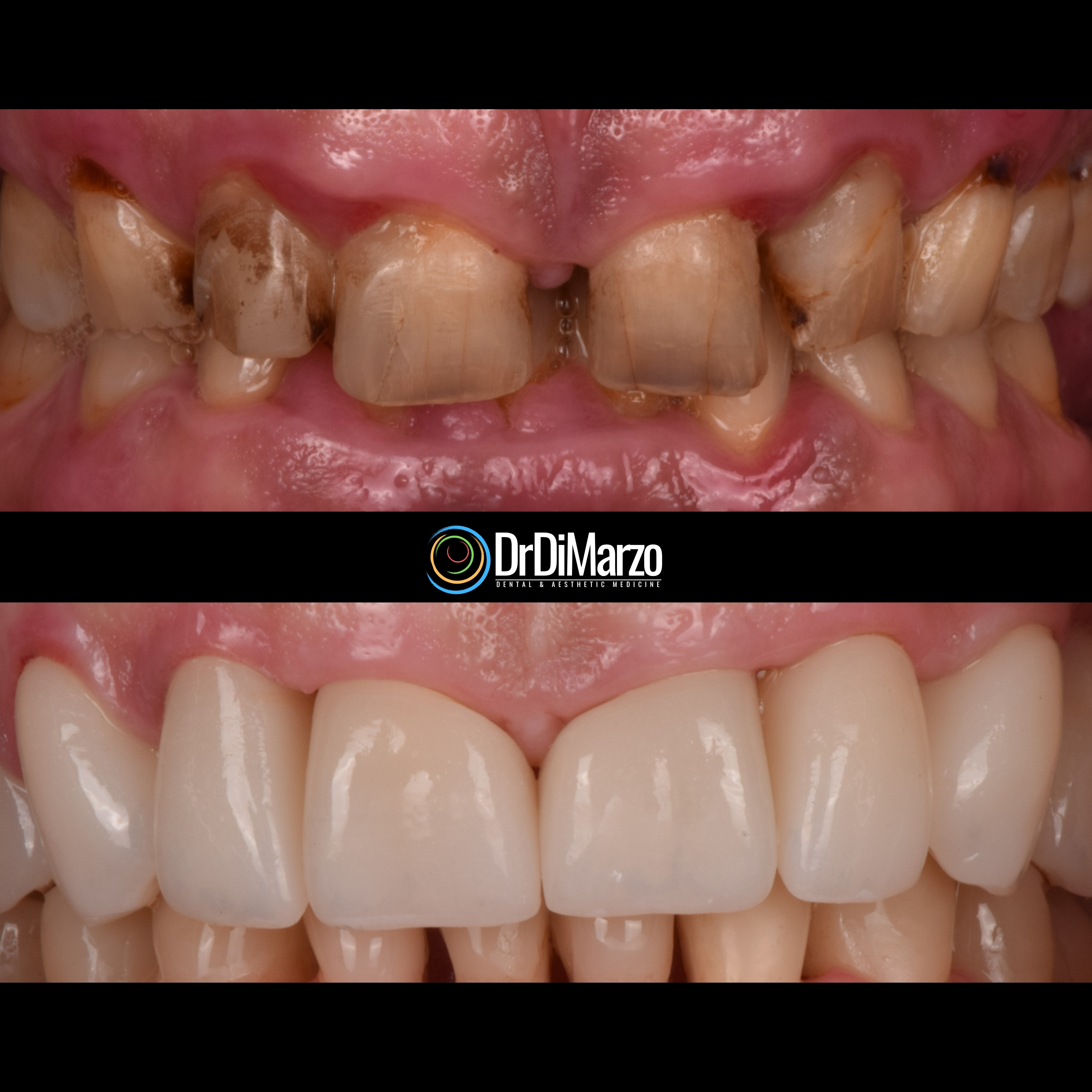 Trasformazione Prima e Dopo