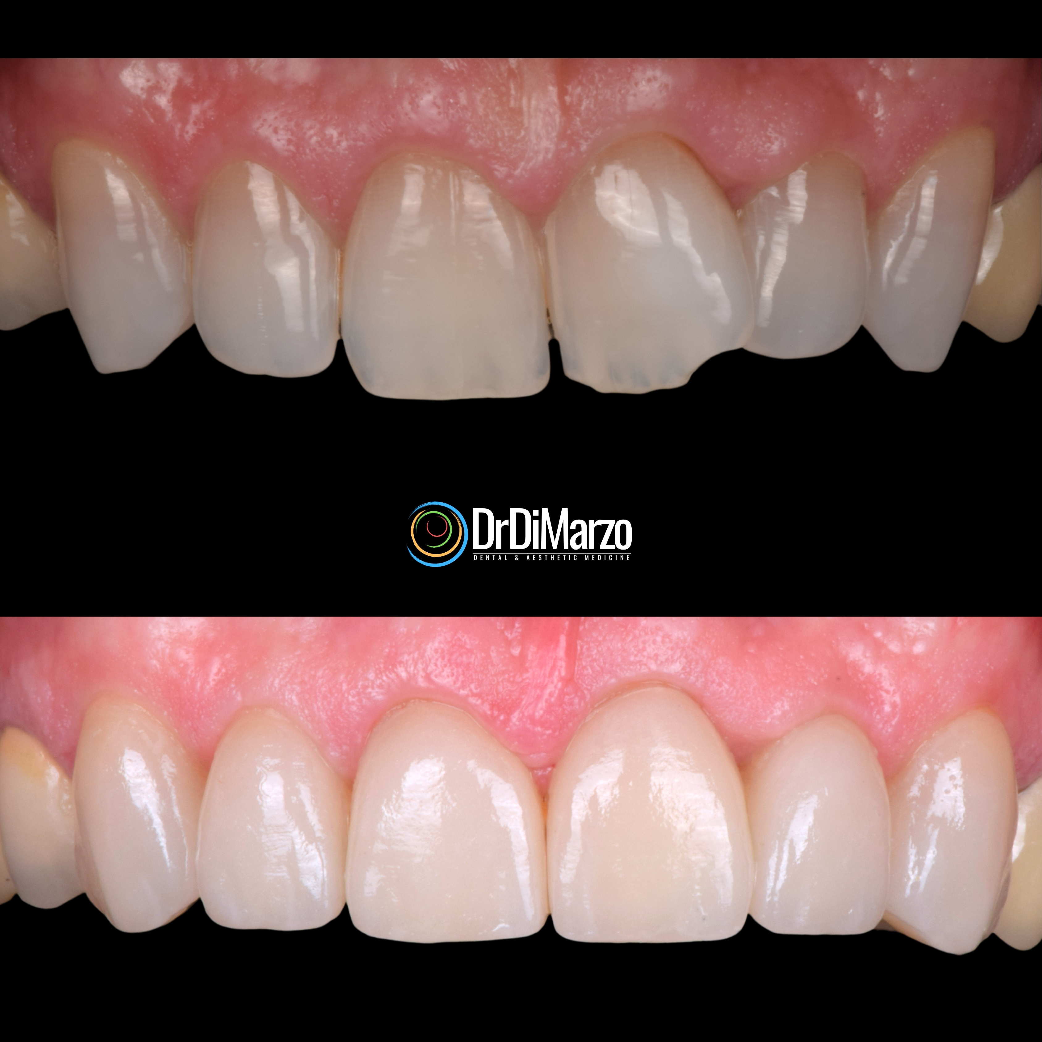 Trasformazione Prima e Dopo