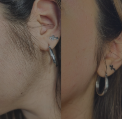 Perfilado de rostro