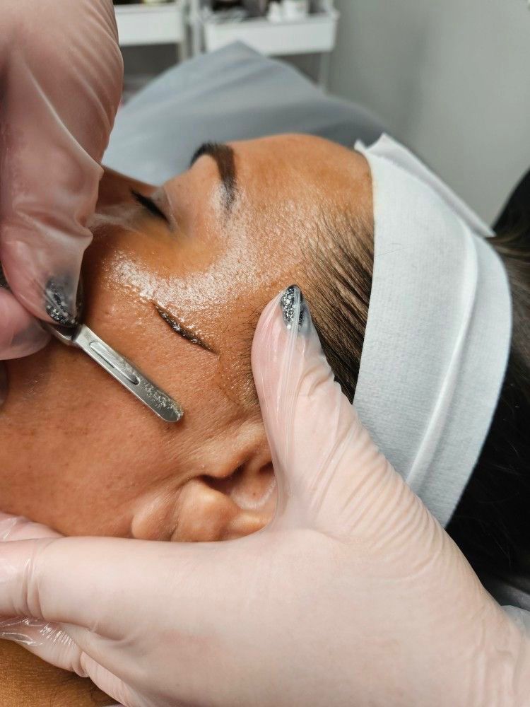 Dermaplaning