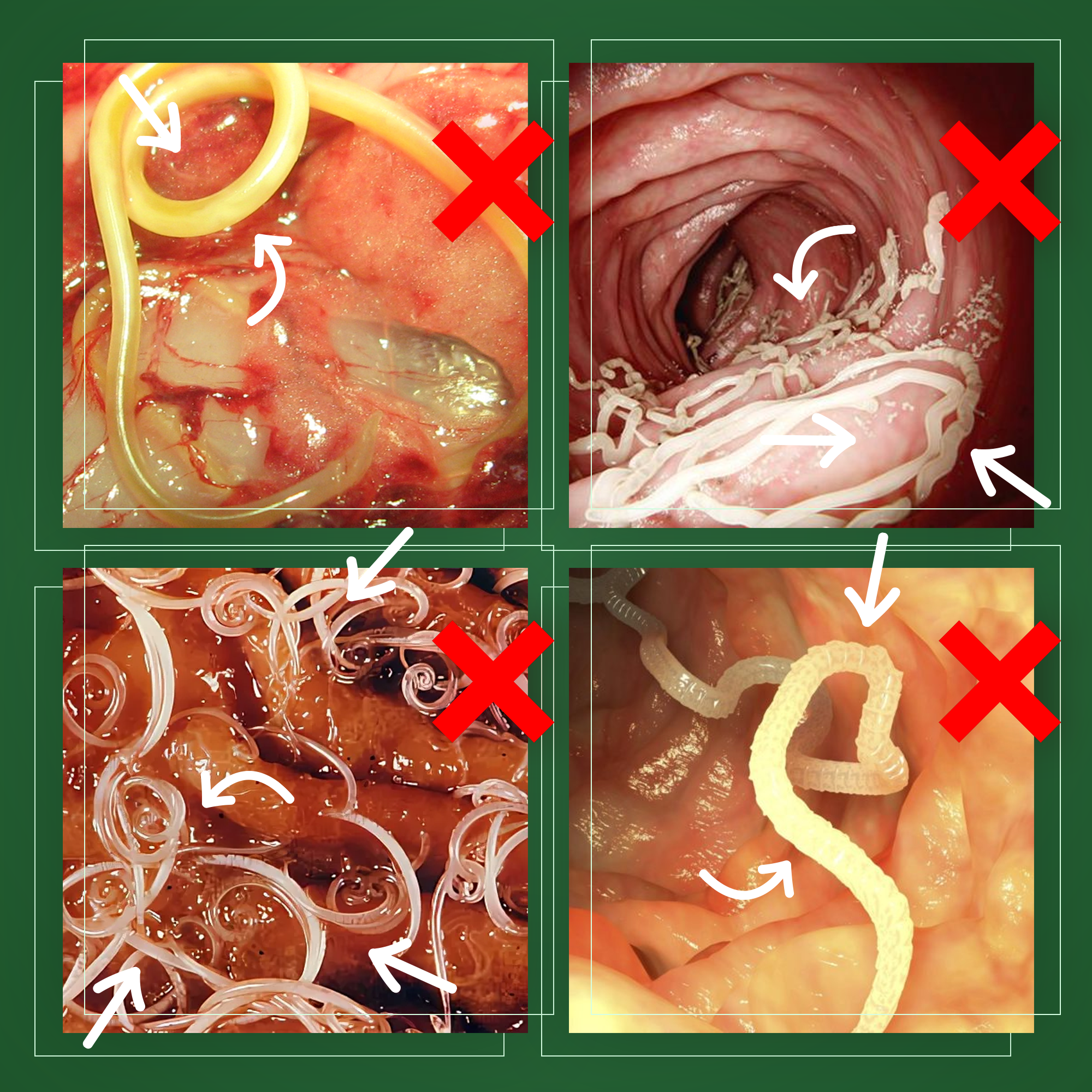 Purevia rebuilds gut environment