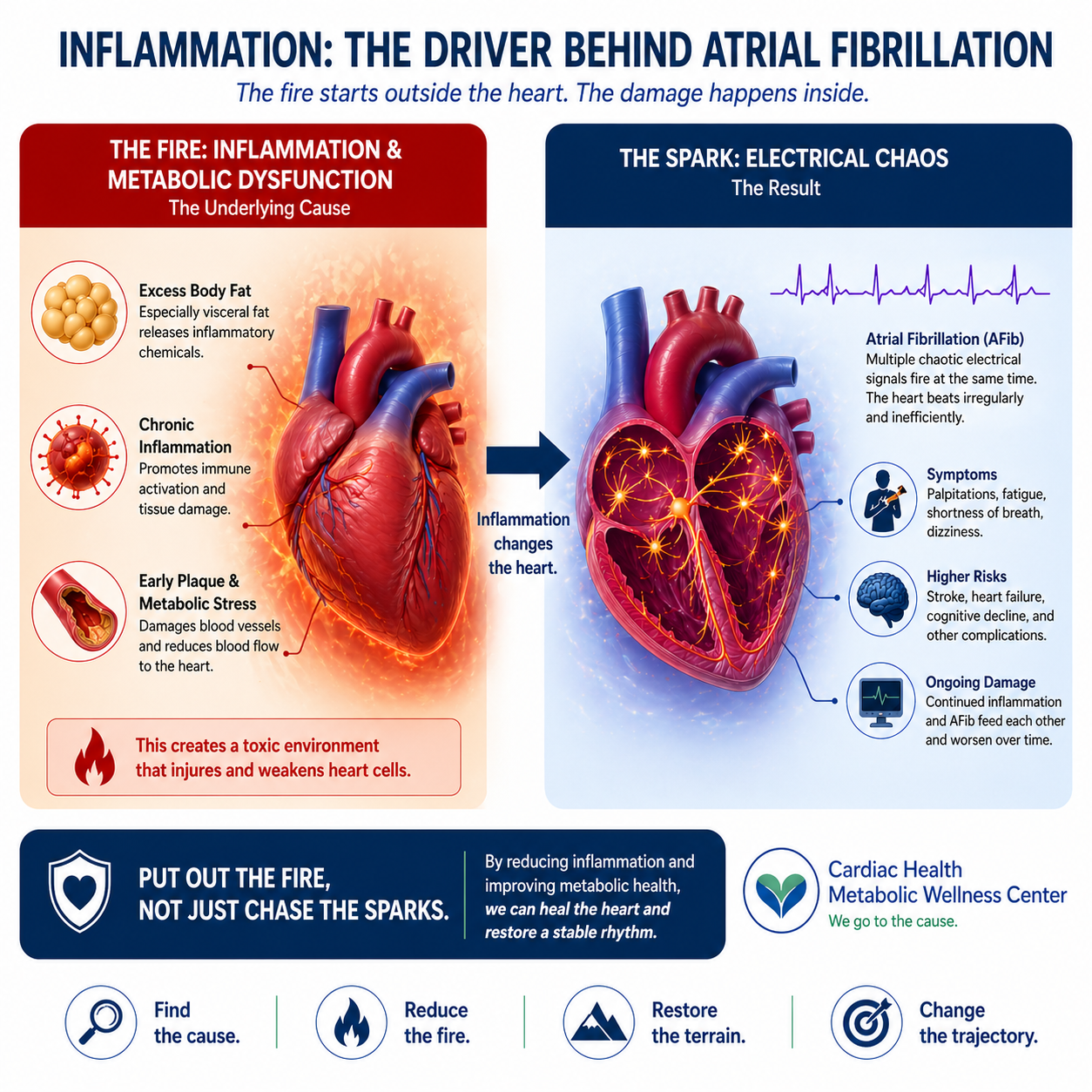 afib