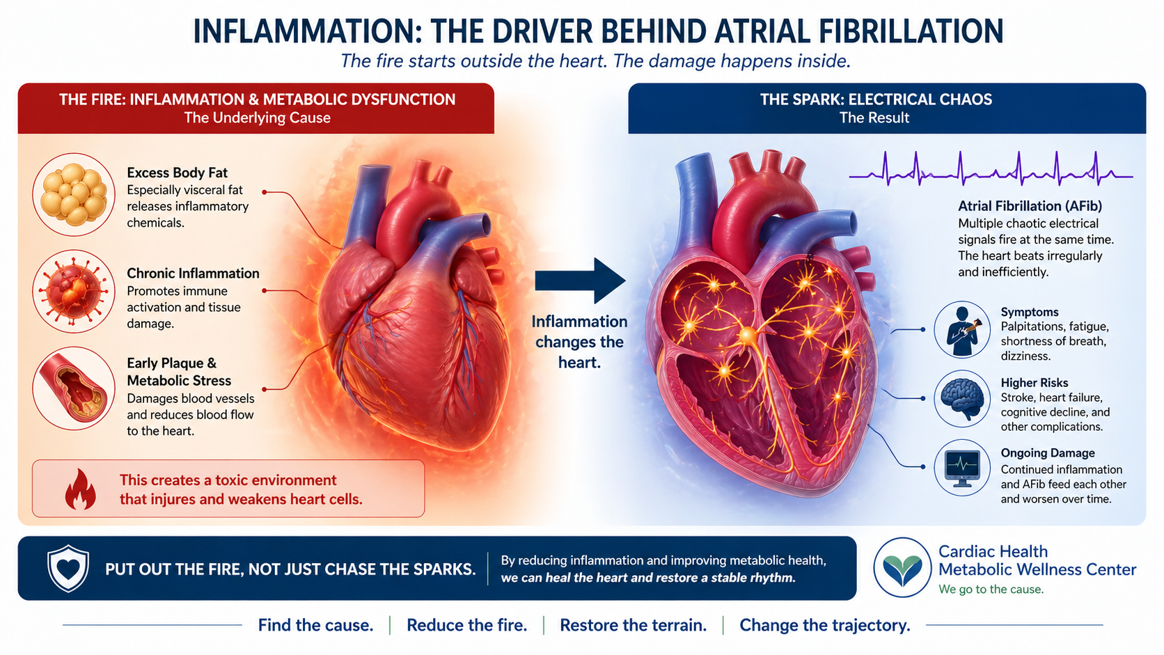 afib