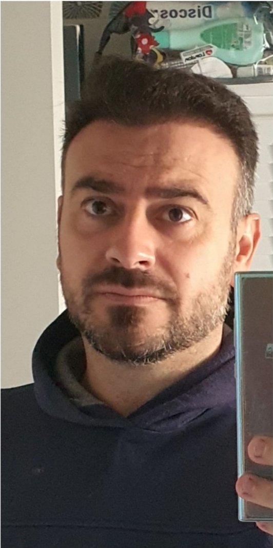 Después caso 2