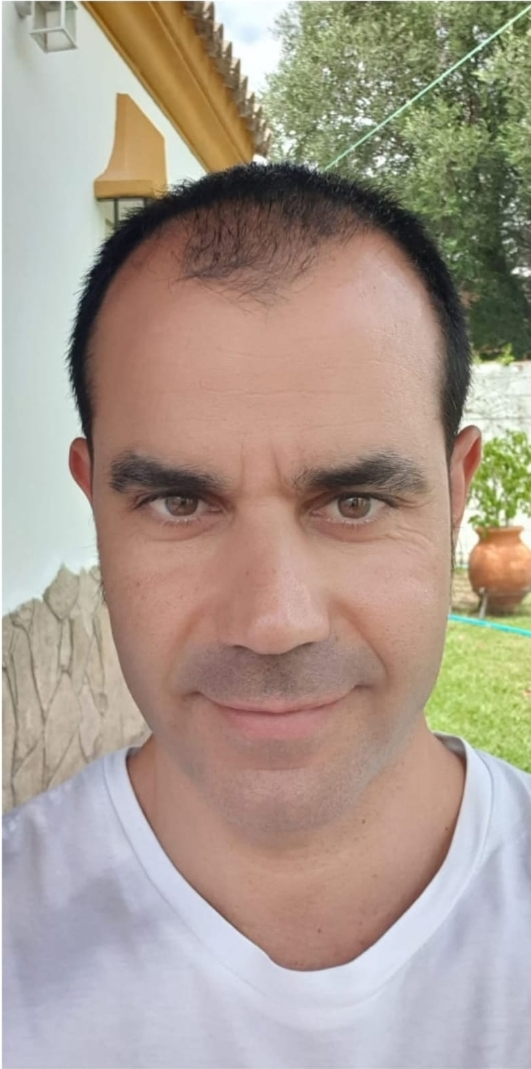 Antes caso 3