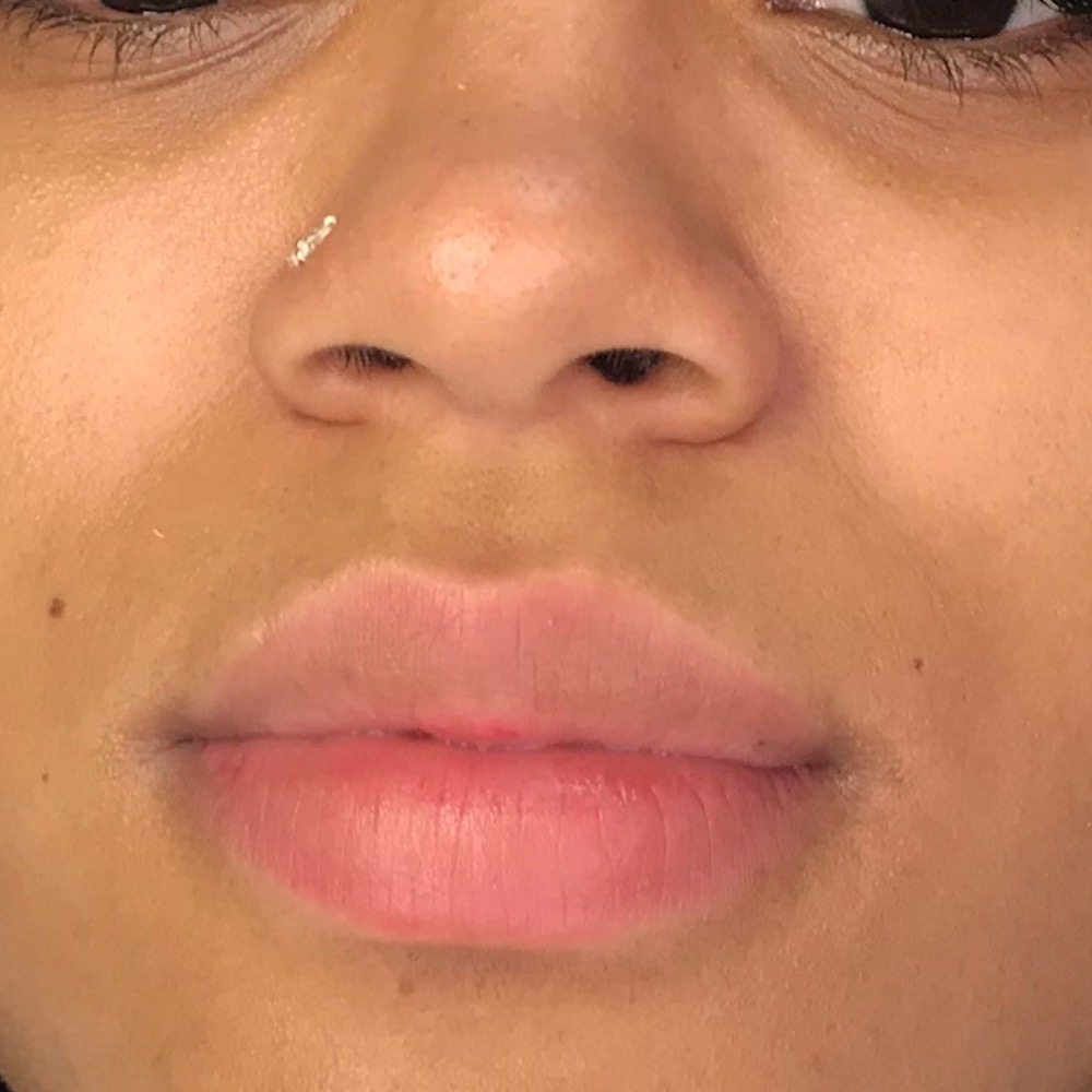 Lip Blush Before