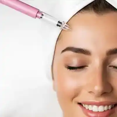 Vampire Facelift Las Vegas