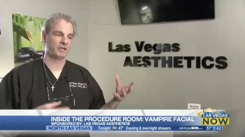 Thomas Pulice discusses the Vampire Facelift on Las Vegas Now, 8NewsNow