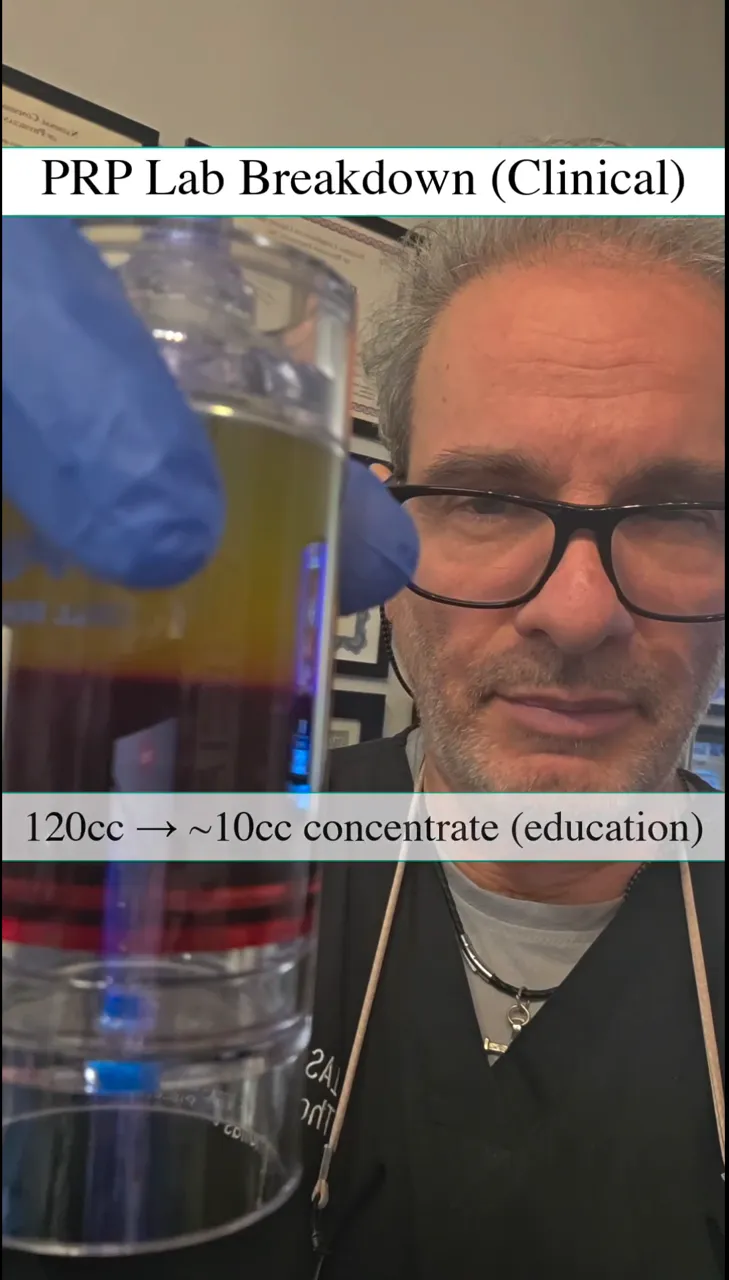EZ Gel platelet-rich fibrin treatment at Las Vegas Aesthetics