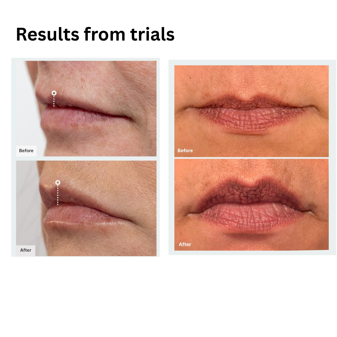 Independent Trials of Lip Treatment Results 