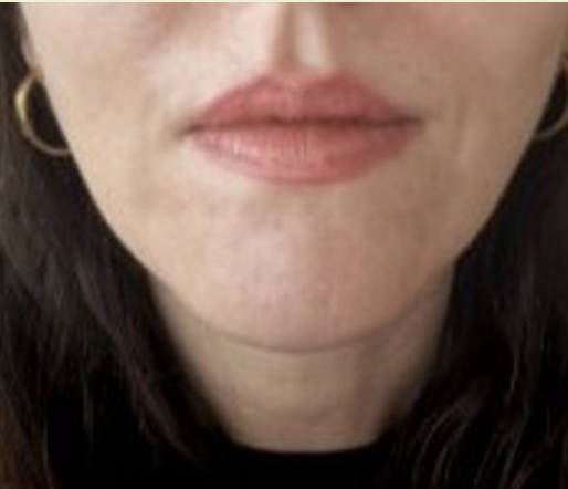 After treatment